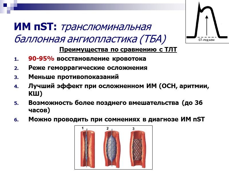 ИМ пST: транслюминальная  баллонная ангиопластика (ТБА) Преимущества по сравнению с ТЛТ 90-95% восстановление